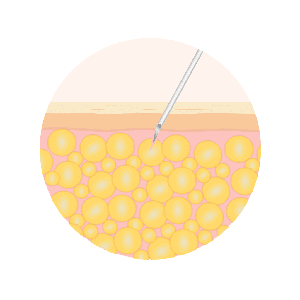 VFACE PROGRAM Waleerat Clinic