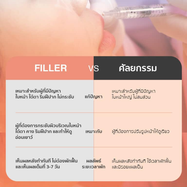 ฟิลเลอร์ vs ศัลยกรรม