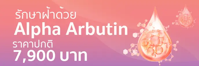 รักษาด้วย Alpha Arbutin
