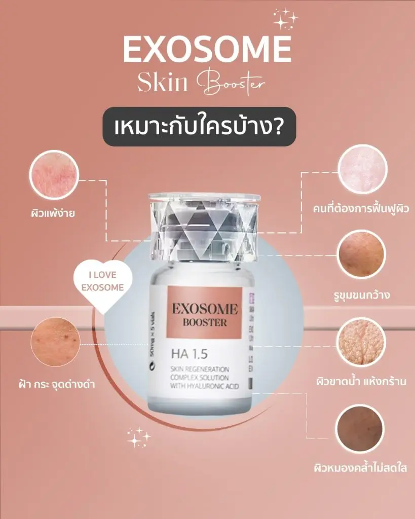 Exosome เหมาะกับใคร