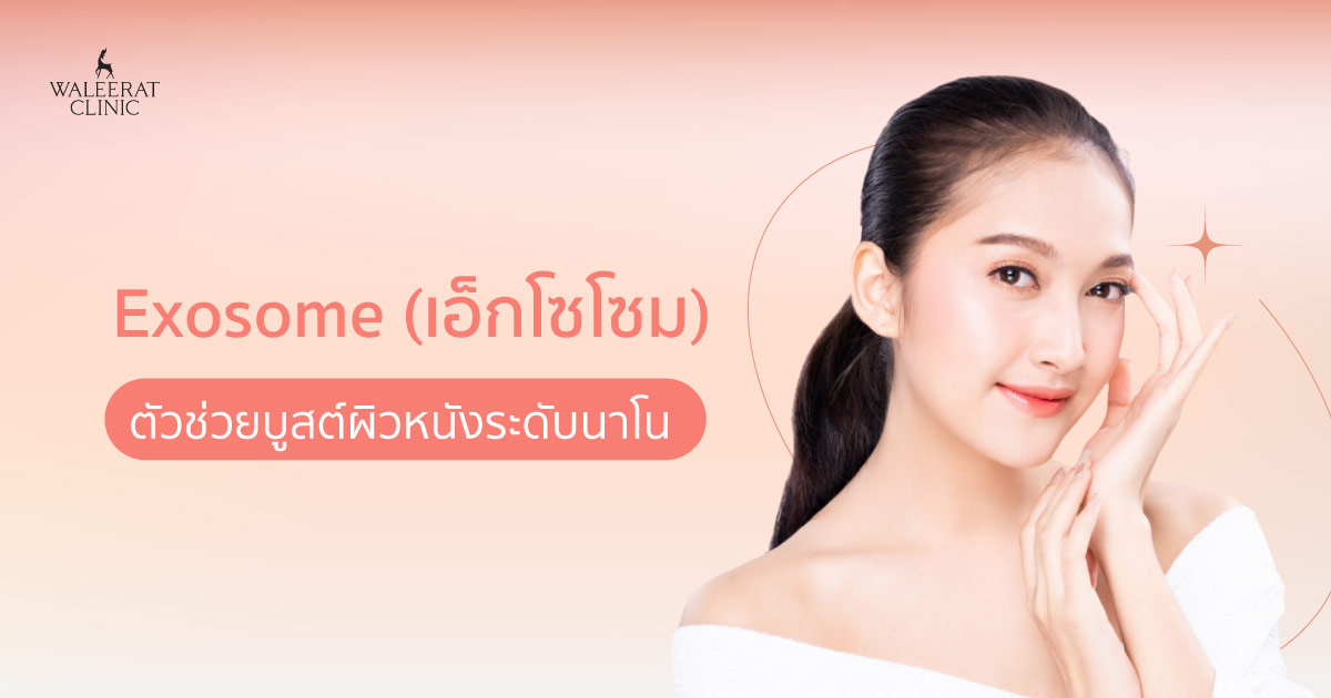 เอ็กโซโซม