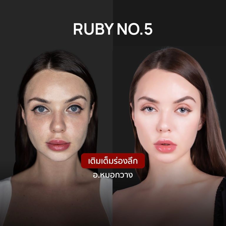 ภาพเปรียบเทียบ Ruby No.5