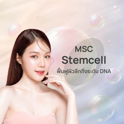 MSC Stemcell ช่วยอะไรได้บ้าง