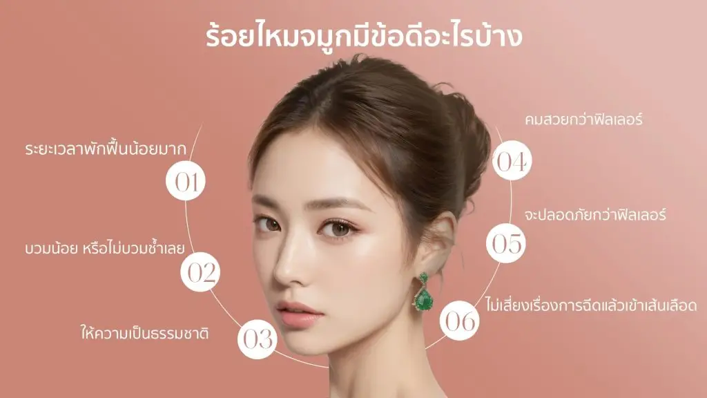 ข้อดีของการร้อยไหมจมูก