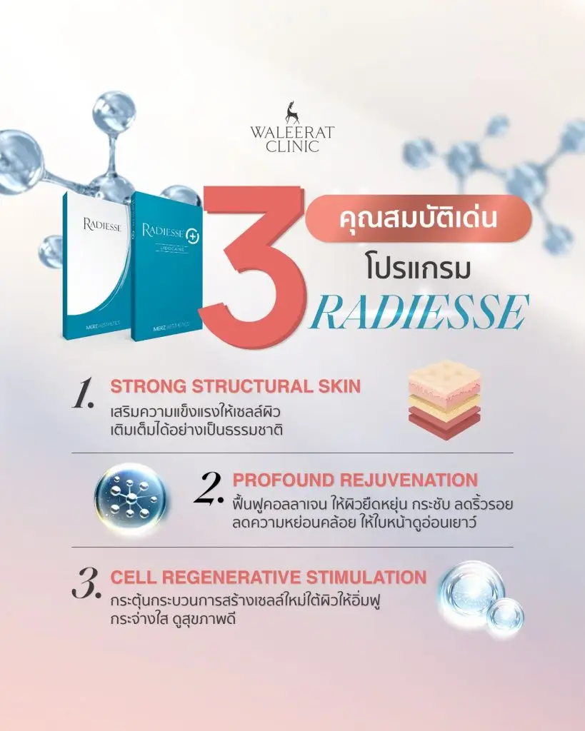 จุดเด่น Radiesse