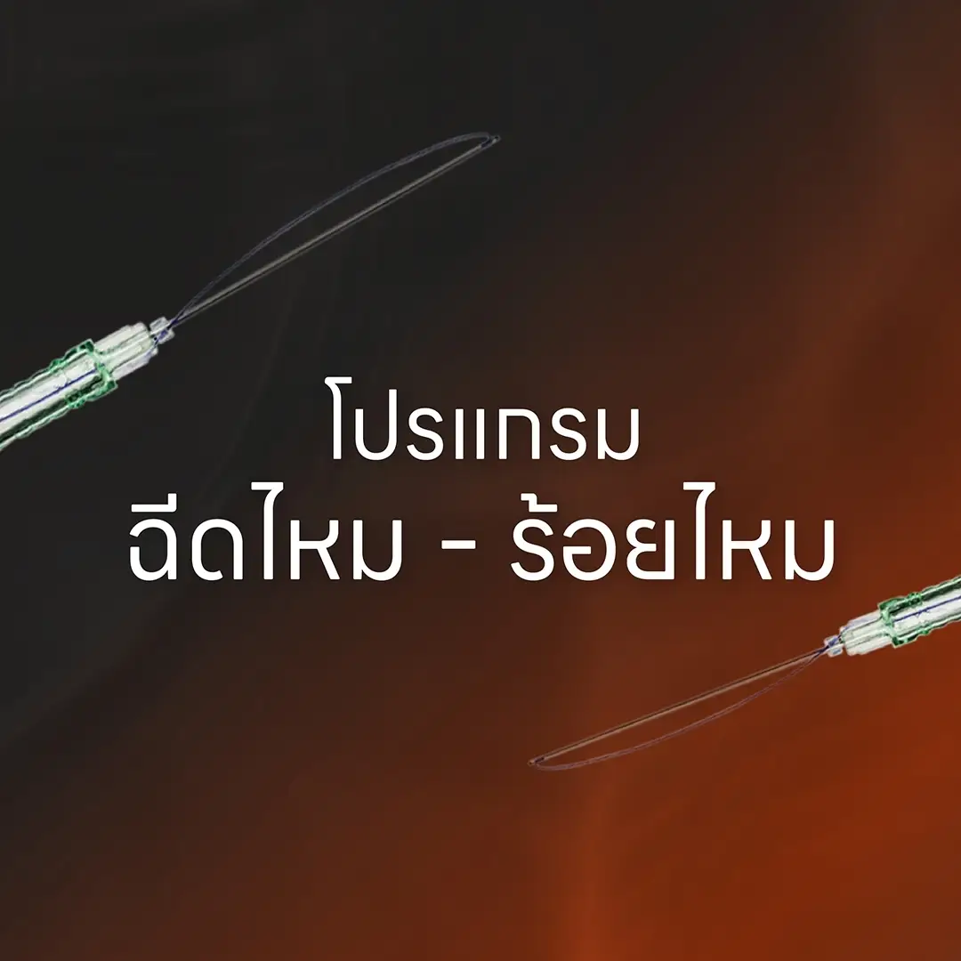 Thread liftiing and Thread Injection Service
