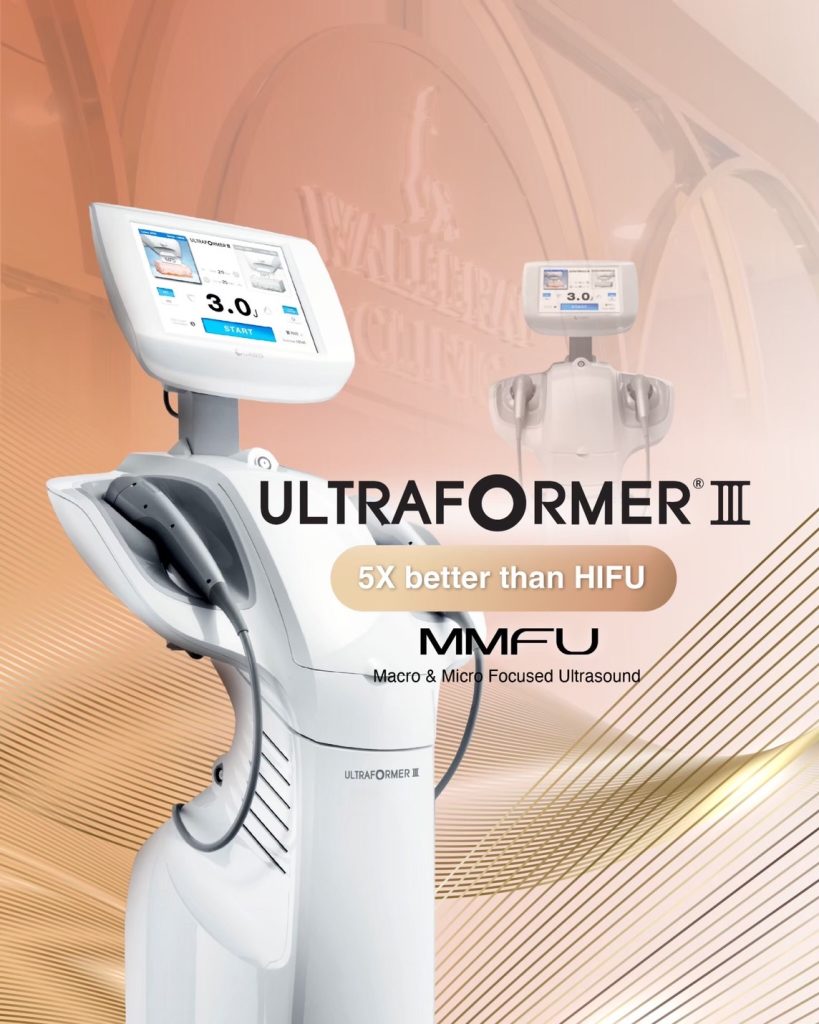 What is Ultraformer III