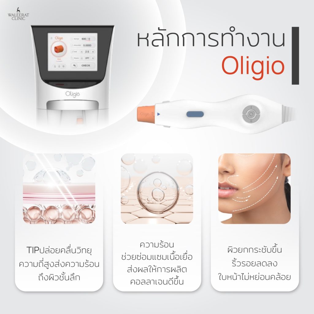 หลักการทำงาน oligio