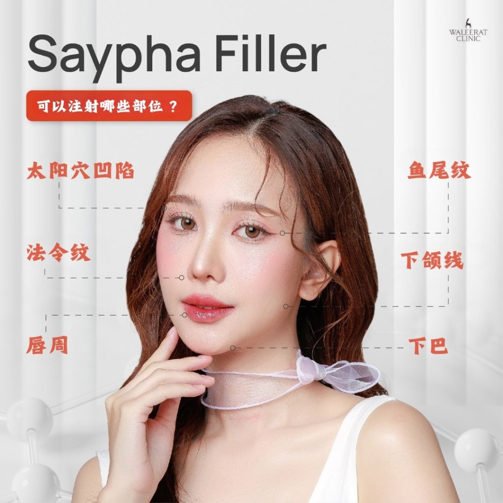 Saypha Filler 可注射部位