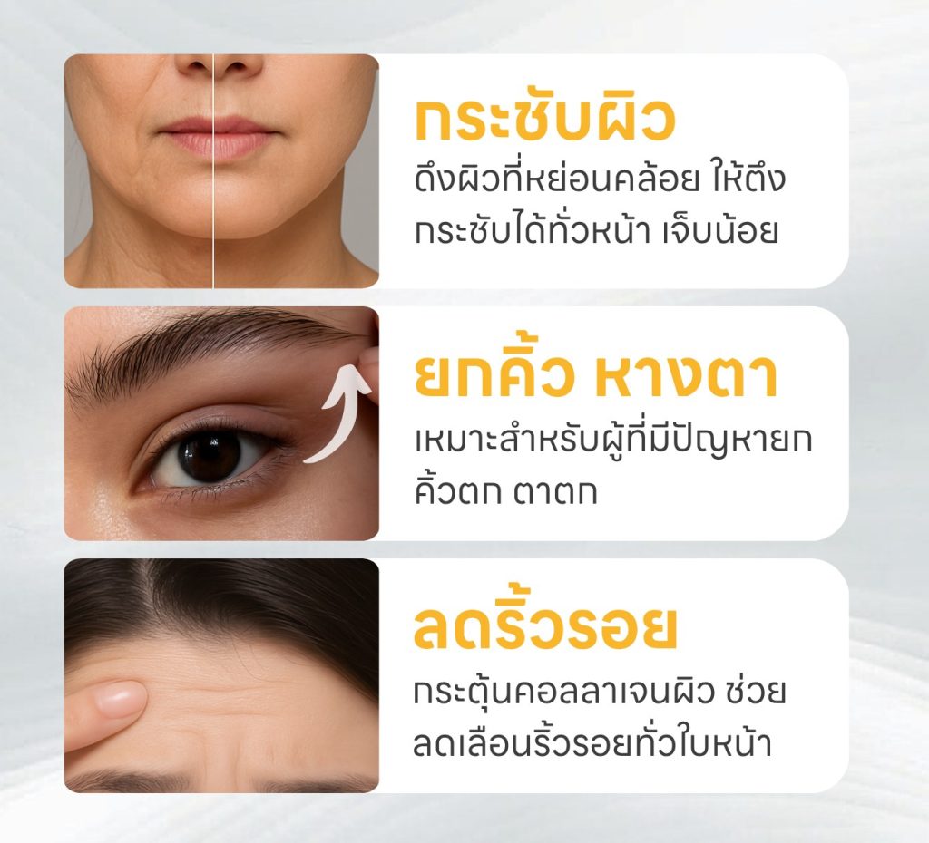 ulthera prime เหมาะกับใคร