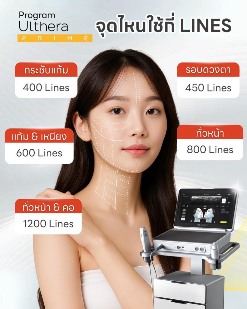 ultherara prime ใช้กี่ line