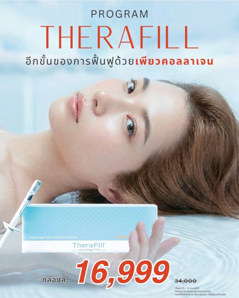 TheraFill ผลลัพธ์ก่อนและหลัง Before After Waleerat Clinic