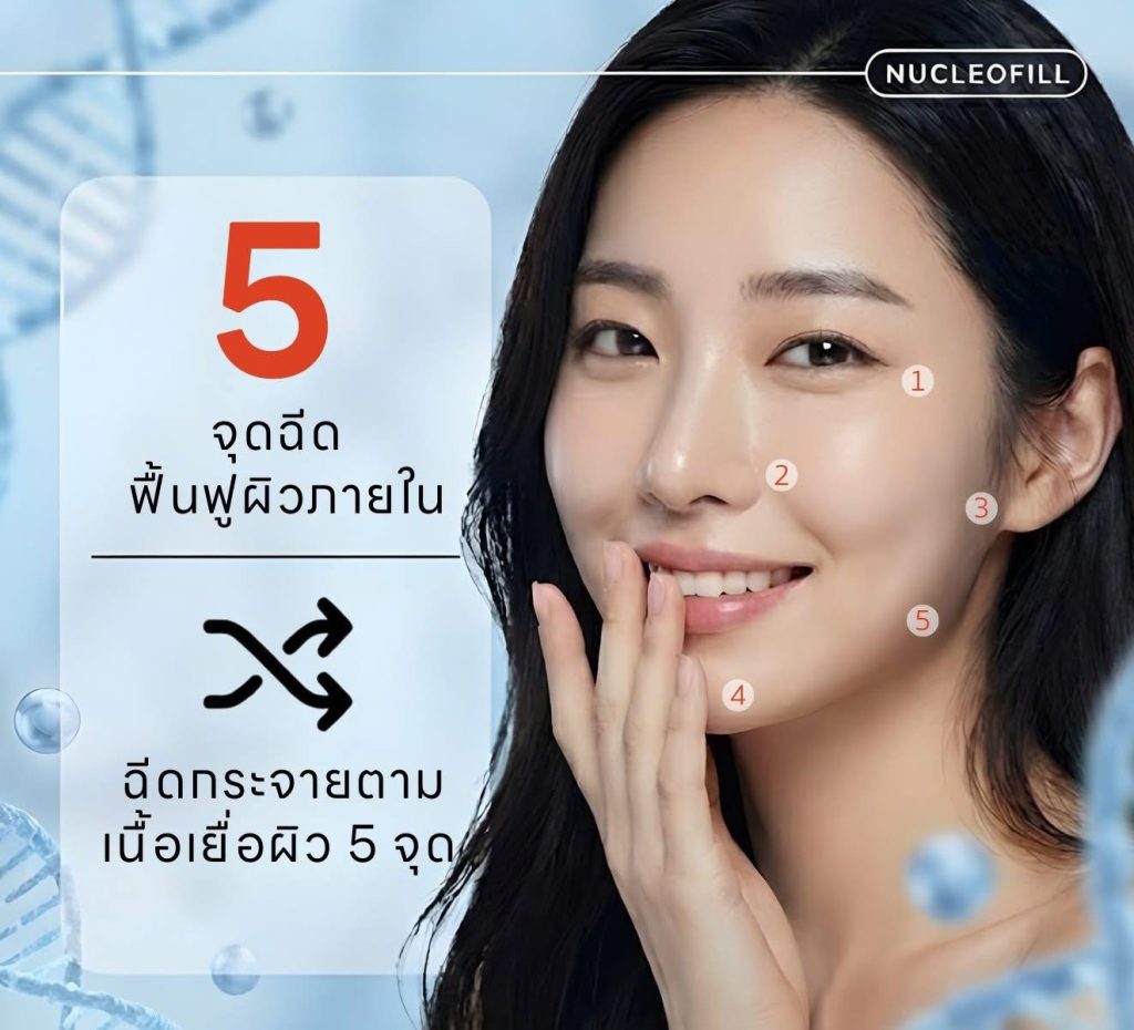 “Nucleofill ฉีดหน้าใส ฟื้นฟูผิว ลดริ้วรอย ช่วยให้ผิวอิ่มฟู ฉ่ำวาว เห็นผลลัพธ์ชัดเจน”