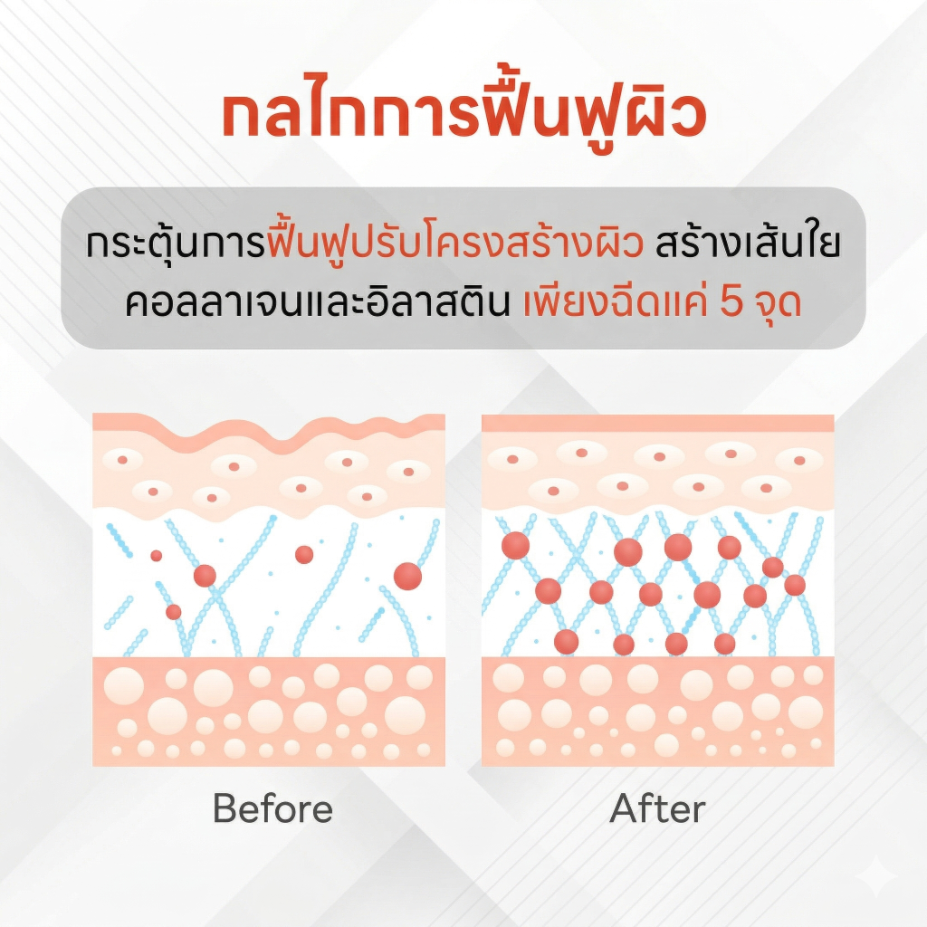 หลักการทำงาน Ejal 40