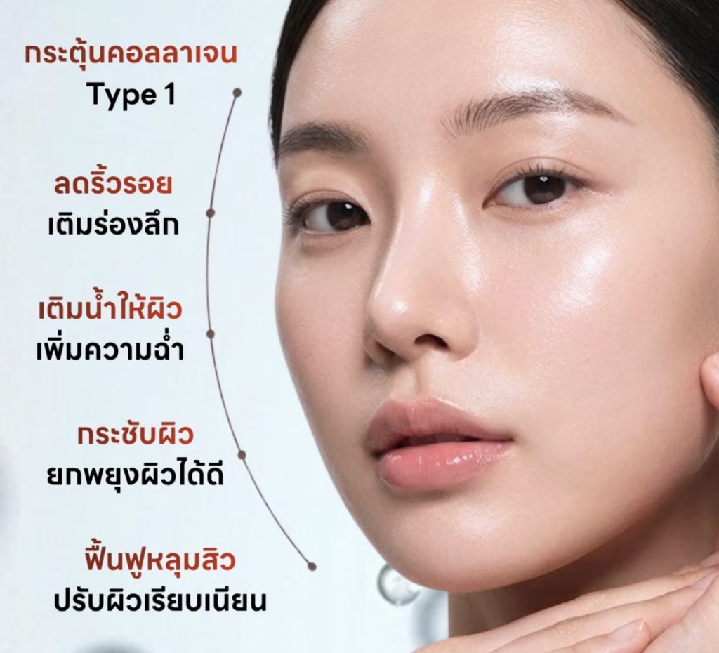 Program Karisma ฟื้นฟูผิว กระตุ้นคอลลาเจน Type 1 ลดริ้วรอย เติมน้ำให้ผิว กระชับผิว และฟื้นฟูหลุมสิว เพื่อผิวเรียบเนียนดูอ่อนเยาว์